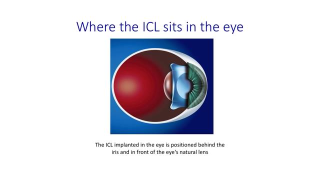 Where is ICL sits in the eye