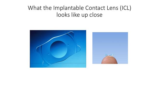 What the Implantable Contact Lens (ICL) looks like up close