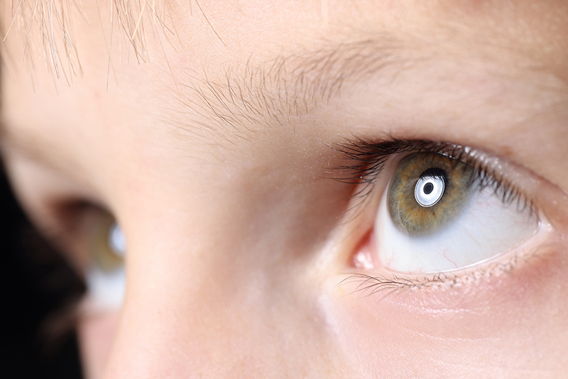 Can Children Get Cataracts? What Parents Should Know
